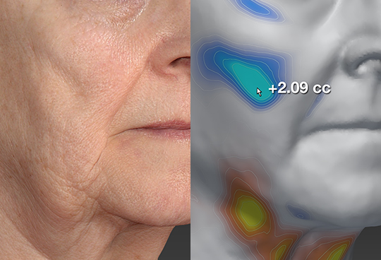 Quantitative Image Analysis and Data Management