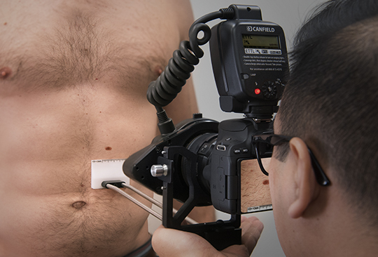 Camera and Lighting System for Clinical Trials Imaging