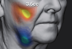 Measure Volume Difference