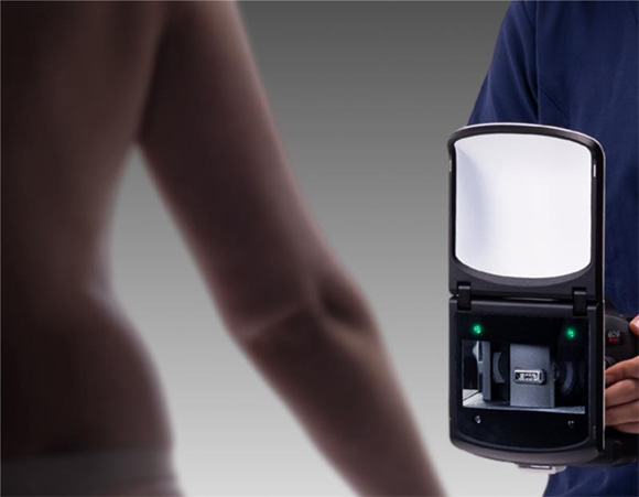 VECTRA H1 handheld 3D imaging
