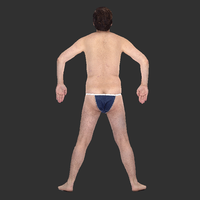 A 3D avatar of a patient's entire body captured by VECTRA WB360