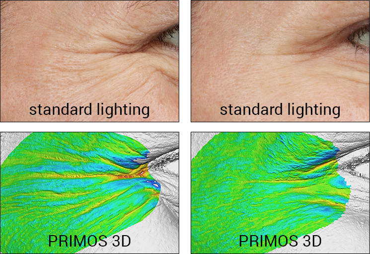 Skin Topography