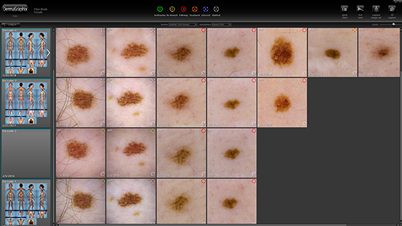 Lesion images organized in DermaGraphix dashboard