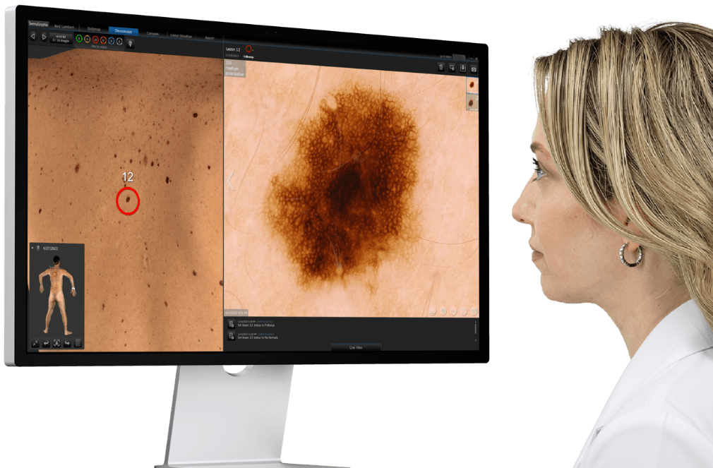 DermaGraphix®